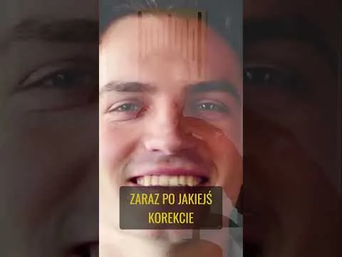 🍬 Dlaczego sprzedajesz akcje za wcześnie? Efekt Marshmallow w akcji! [Efekt Marshmallow i Inwestowanie]